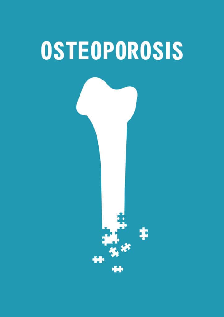 osteoporosis